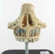 RARE TOOTH ERUPTION MODEL