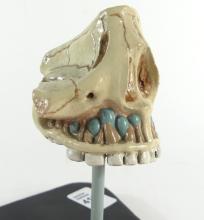 RARE TOOTH ERUPTION MODEL